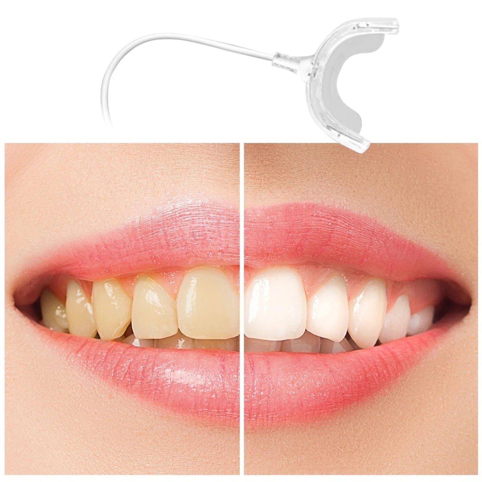 Teeth Whitening Device Equipment